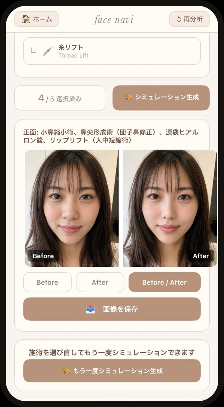 施術シミュレーションのBefore/After画面